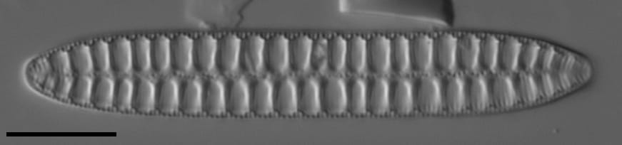 Surirella arctica LM1