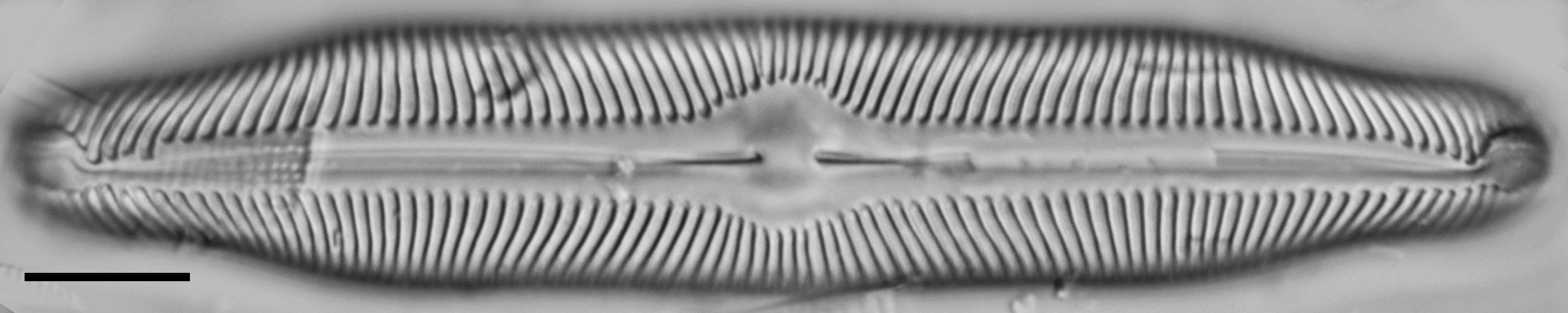 Pinnularia decrescens LM5