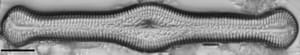 Pinnularia turgidula LM2