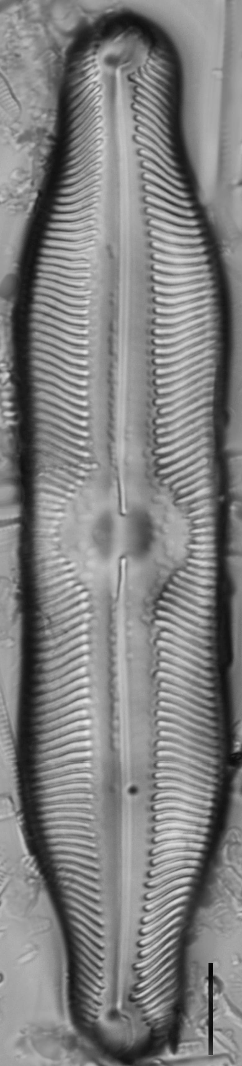 Pinnularia undula var. major LM2