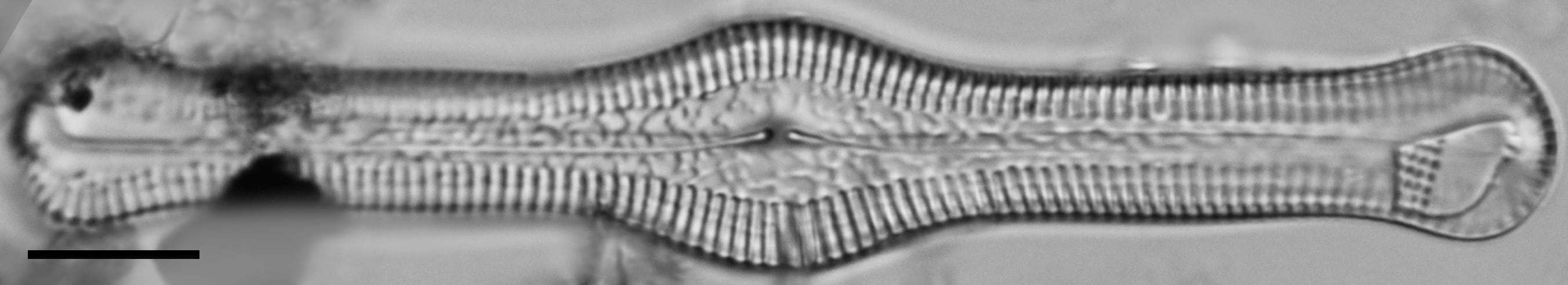 Pinnularia turgidula LM4