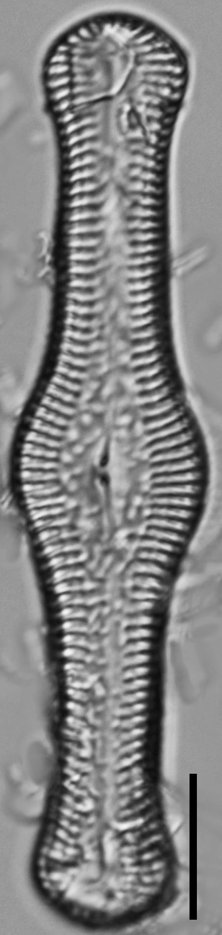 Pinnularia turgidula LM5