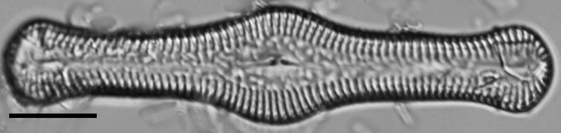 Pinnularia turgidula LM5