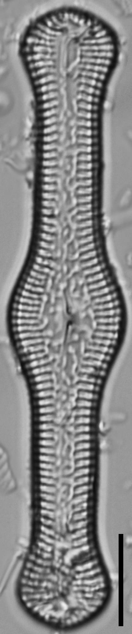 Pinnularia turgidula LM6