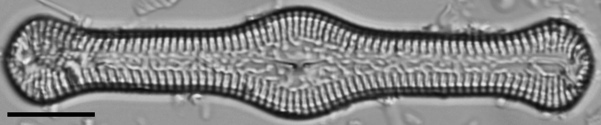 Pinnularia turgidula LM6