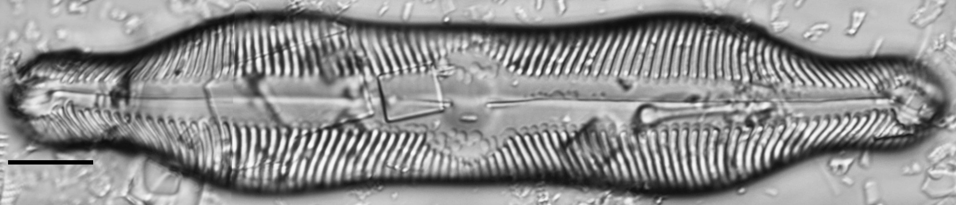 Pinnularia undula var. major LM5