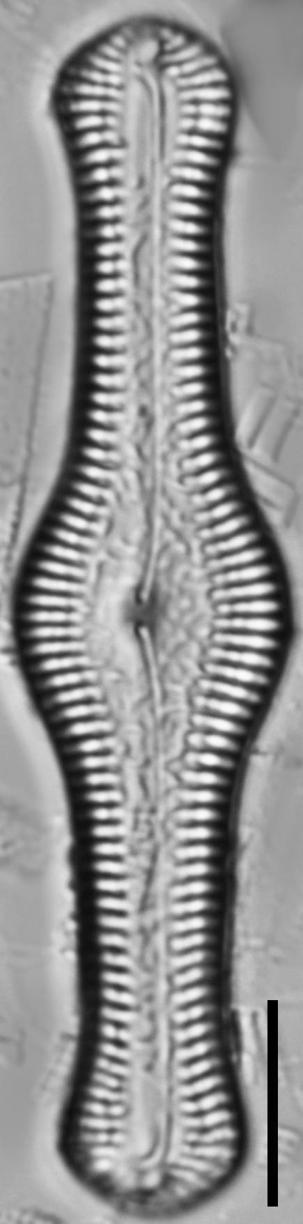 Pinnularia turgidula LM7