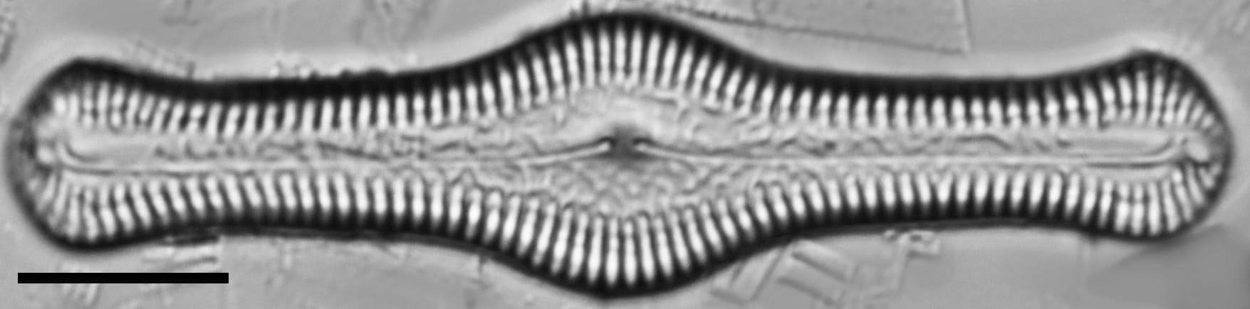 Pinnularia turgidula LM7