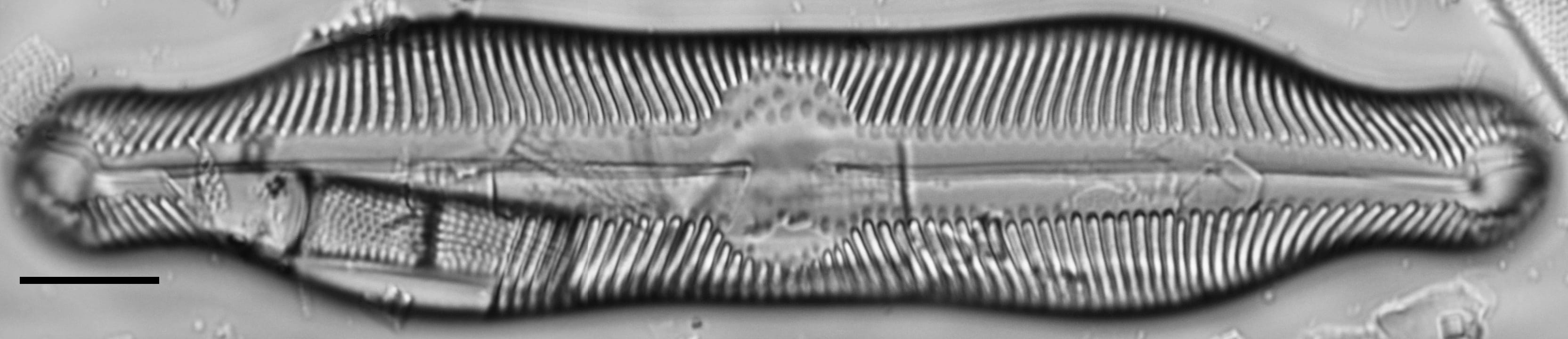 Pinnularia undula var. major LM6