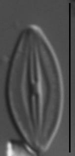 Microcostatus krasskei LM3