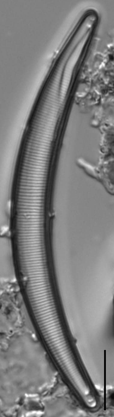 Eunotia sarraceniae LM7