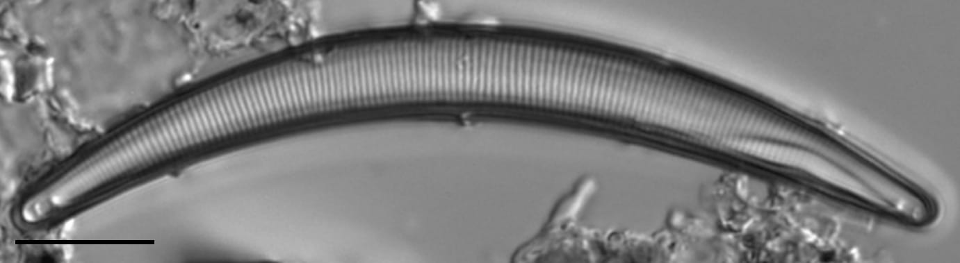 Eunotia sarraceniae LM7