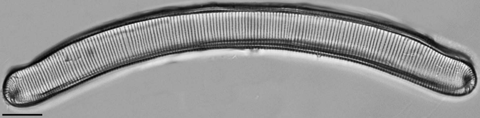 Eunotia pseudoparallela LM1