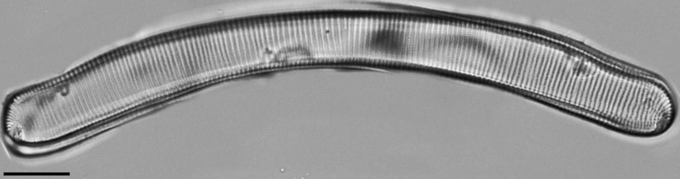 Eunotia pseudoparallela LM2