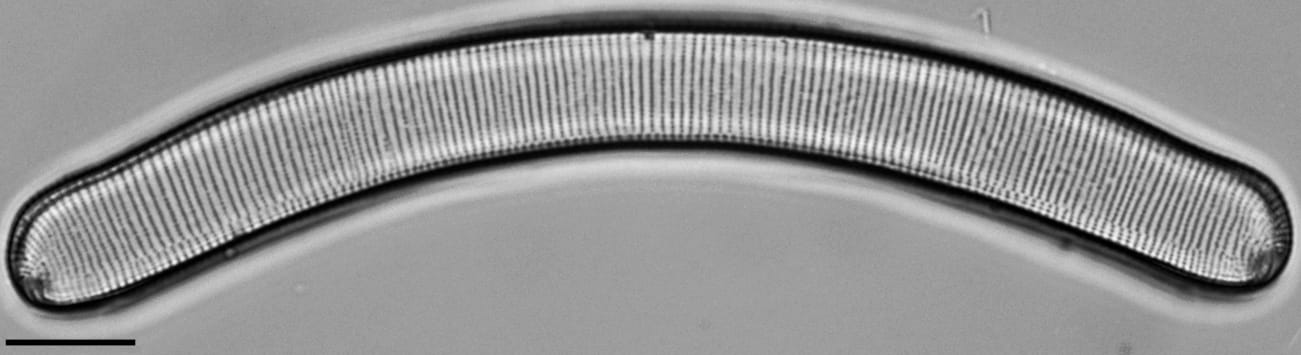 Eunotia pseudoparallela LM3