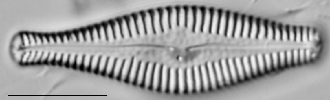 Gomphonema manubrium LM2