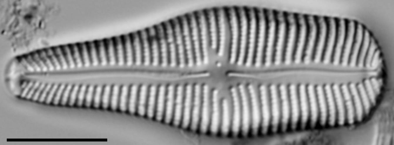 Gomphonema turgidum LM2