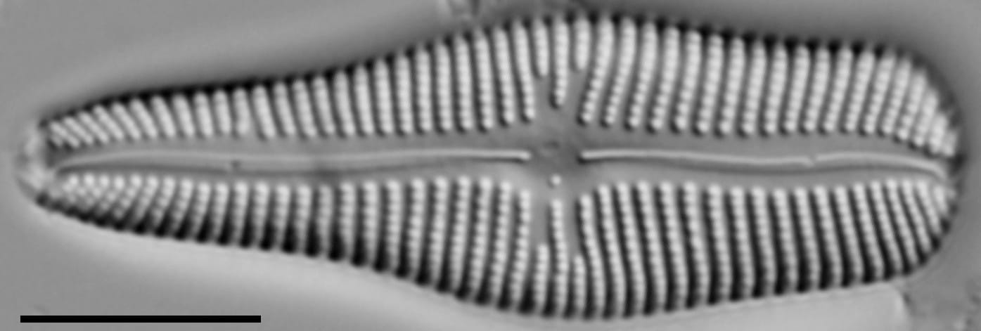 Gomphonema turgidum LM3