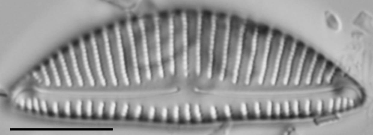 Encyonema minutum var pseudogracilis LM1