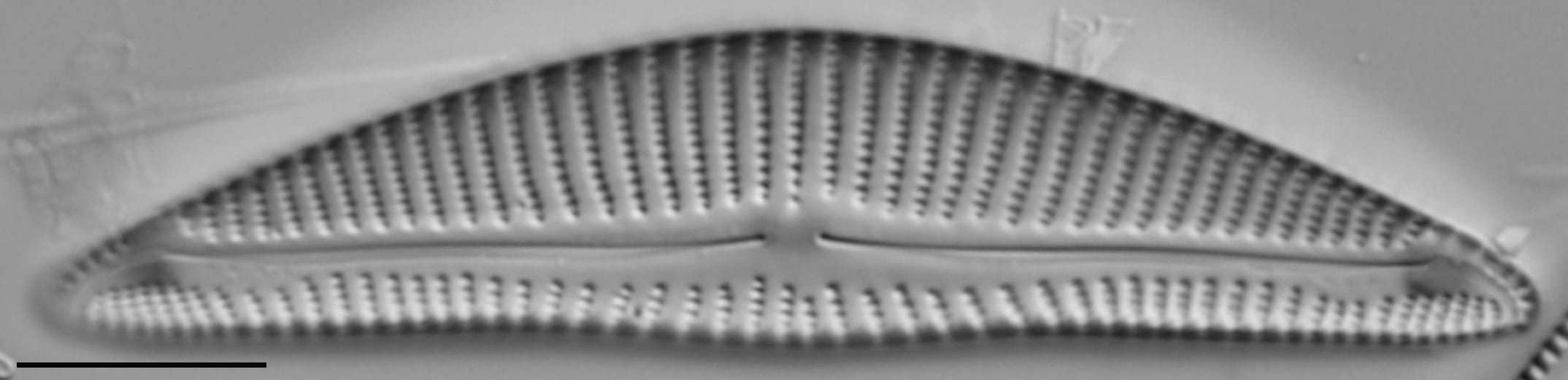 Encyonema minutum var pseudogracilis LM6