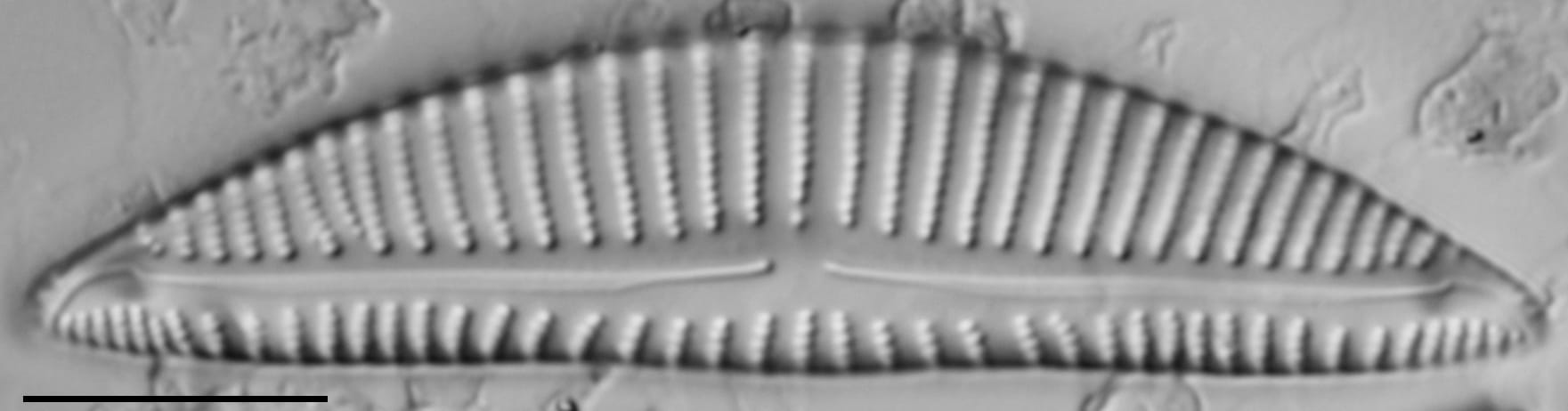 Encyonema minutum var pseudogracilis LM4