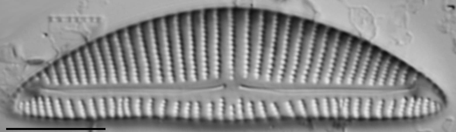 Encyonema minutum var pseudogracilis LM5