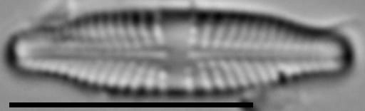 Stauroneis thermicola LM5