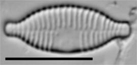 Fragilaria recapitellata LM3
