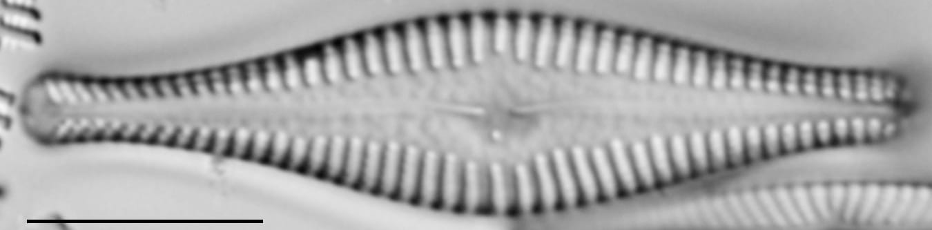 Gomphonema manubrium LM5