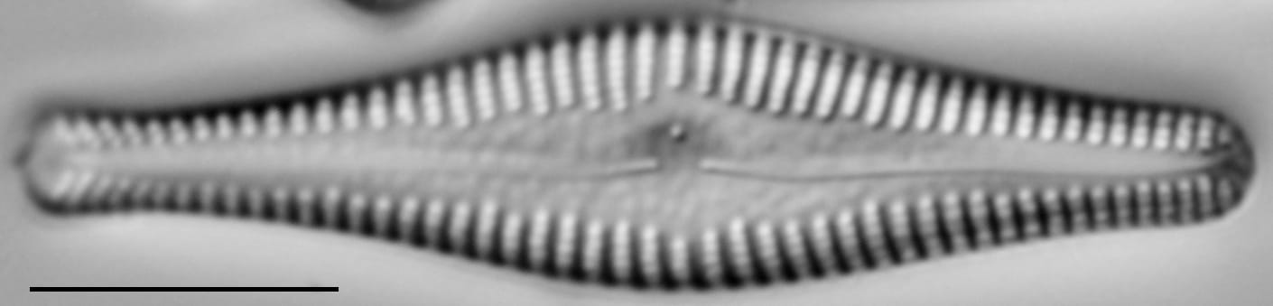 Gomphonema manubrium LM6