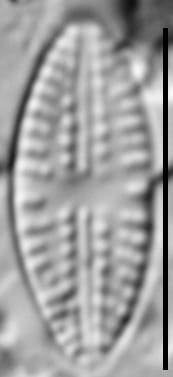 Eolimna sp.1 SESQA LM1