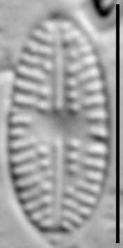 Eolimna sp.1 SESQA LM5