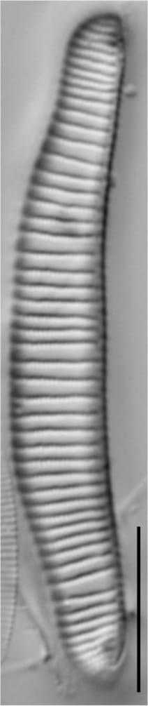 Eunotia implicata LM2