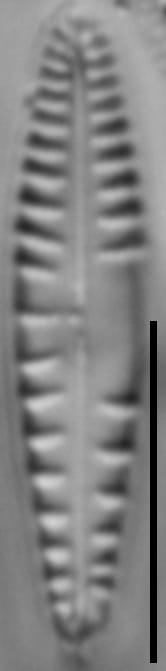 Gomphonema variostriatum LM2