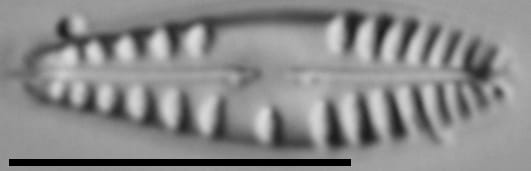 Gomphonema variostriatum LM3