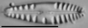 Gomphonema variostriatum LM3