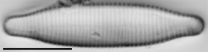 Fragilariforma virescens LM2