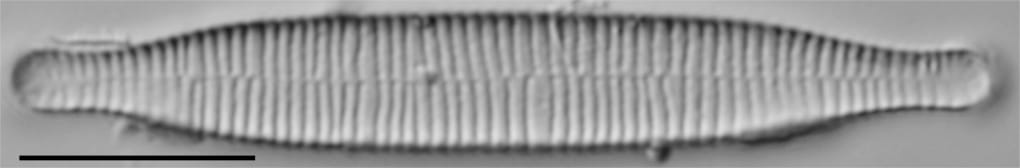 Fragilariforma virescens LM3