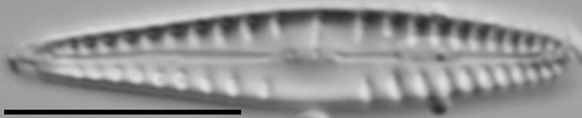 Gomphonema variostratum LM5