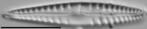 Gomphonema variostratum LM5