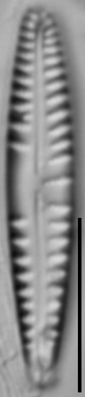 Gomphonema variostriatum LM4