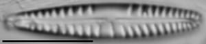 Gomphonema variostriatum LM4