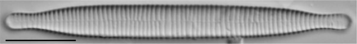 Fragilariforma virescens LM6