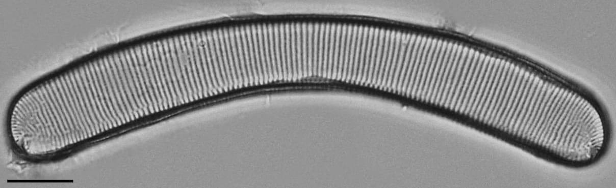 Eunotia pseudoparallela LM4