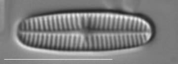 Rossithidium pusillum LM2