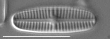 Rossithidium pusillum LM4