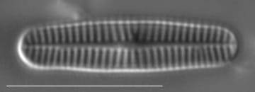 Rossithidium pusillum LM6