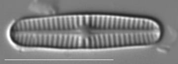 Rossithidium pusillum LM8