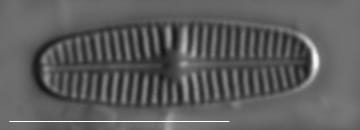 Rossithidium pusillum LM10