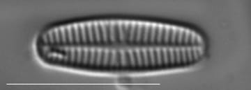 Rossithidium pusillum LM12